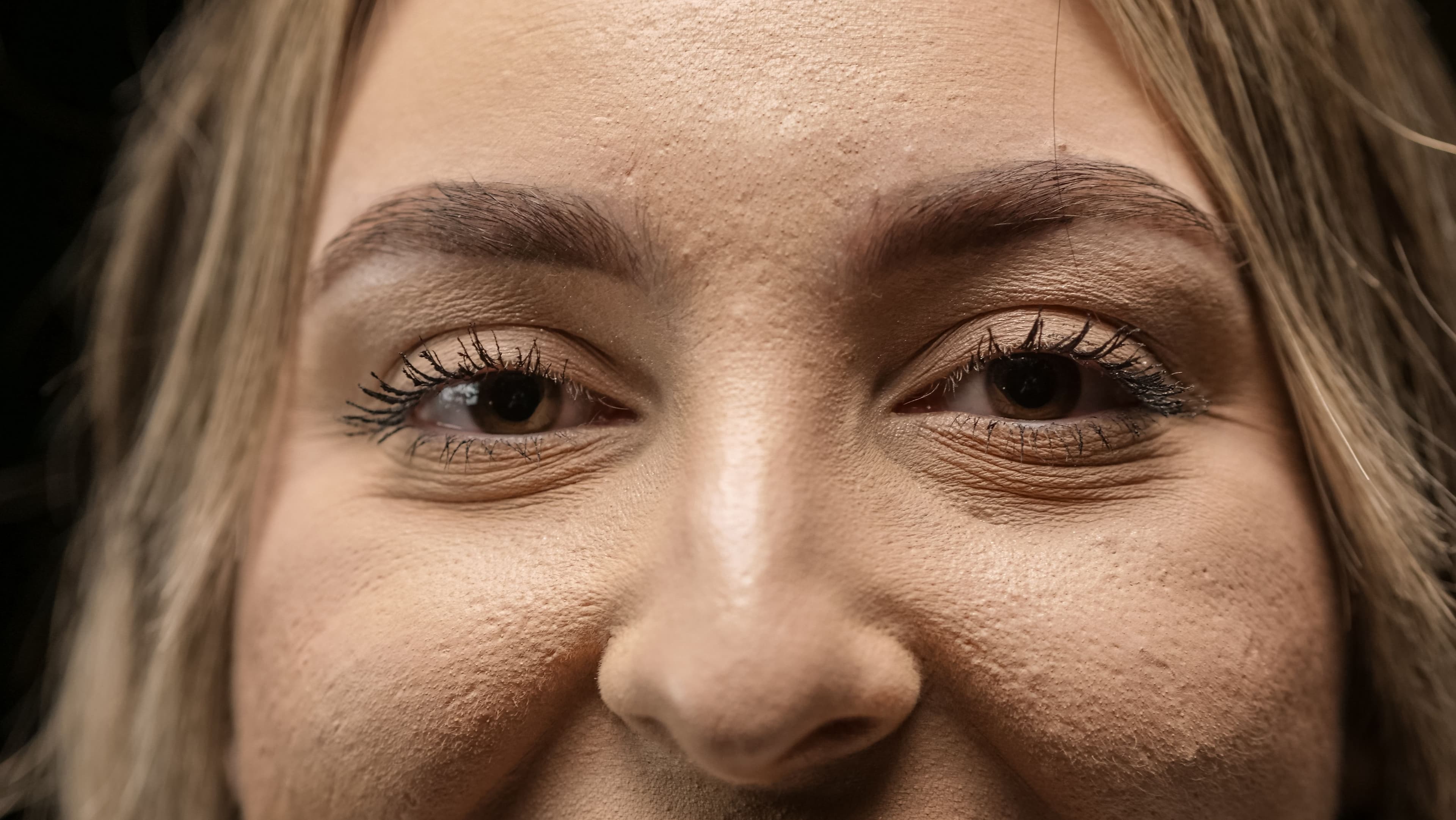 Close-up macro shot of skin texture and pores