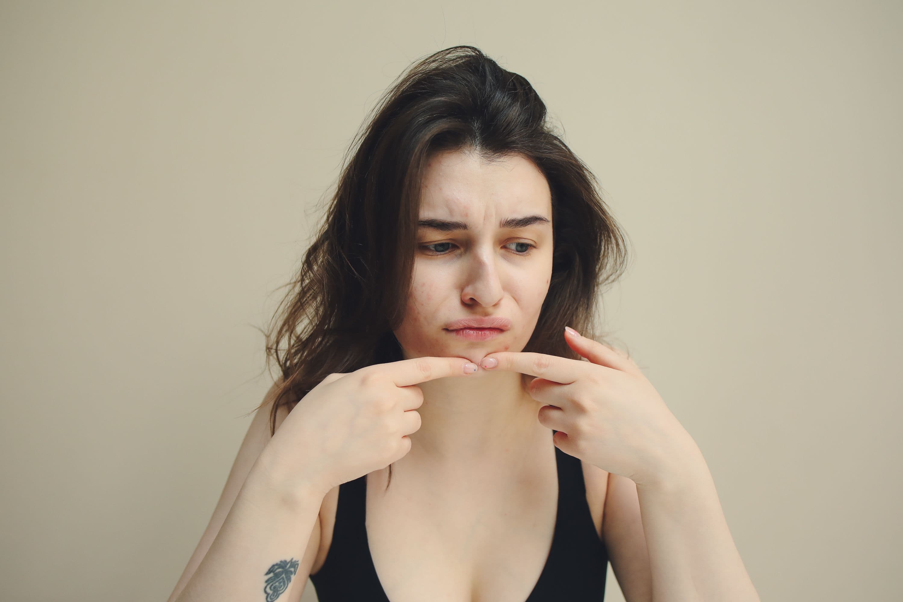 Close-up of clear skin with a person applying a spot treatment to a single pimple